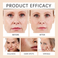 Oumun Retinol Collagen Cream for Face With 5% Hyaluronic Acid,Face Cream for Women,Retinol Face Cream With Collagen,Retinol Serum for Face,Anti-Aging Retinol Cream,Anti Wrinkle Face Cream,Night Moisturiser