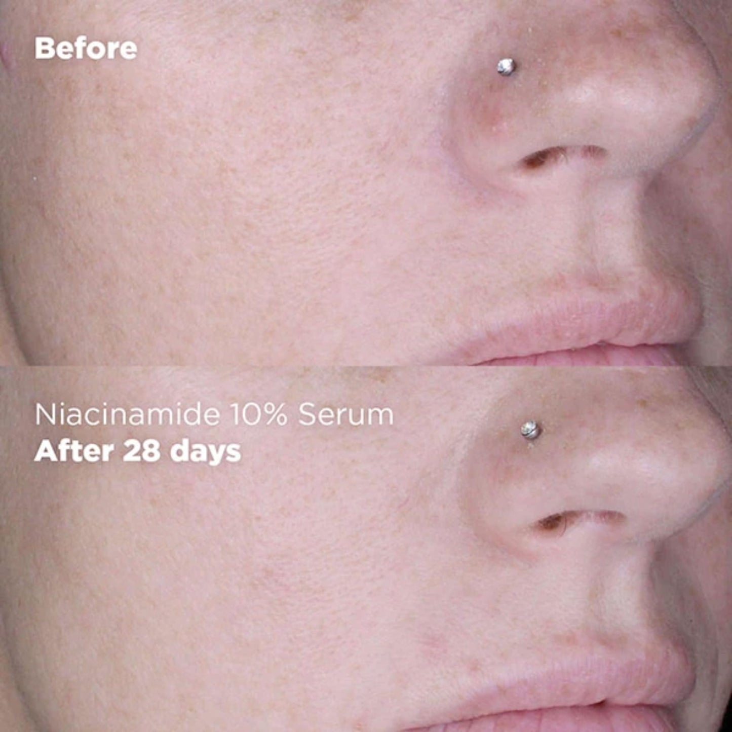 Skin Republic Niacinamide 10% + Zinc 1% Brightening Serum, Minimises Excess Oil, Pigmentation & Uneven Skin Tone (30ml)