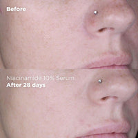Skin Republic Niacinamide 10% + Zinc 1% Brightening Serum, Minimises Excess Oil, Pigmentation & Uneven Skin Tone (30ml)