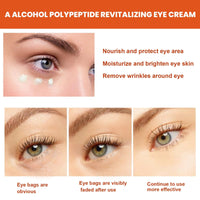 OuXing Eyelift Serum Mango Revitalize Eye Cream,eye cream for dark circles and puffy eyes,Hyaluronic Acid Repair Cream,eye bag crea-m,Wrinkles Eye Creams Oil Essence Firming Crea-m,eye tightening cre-am