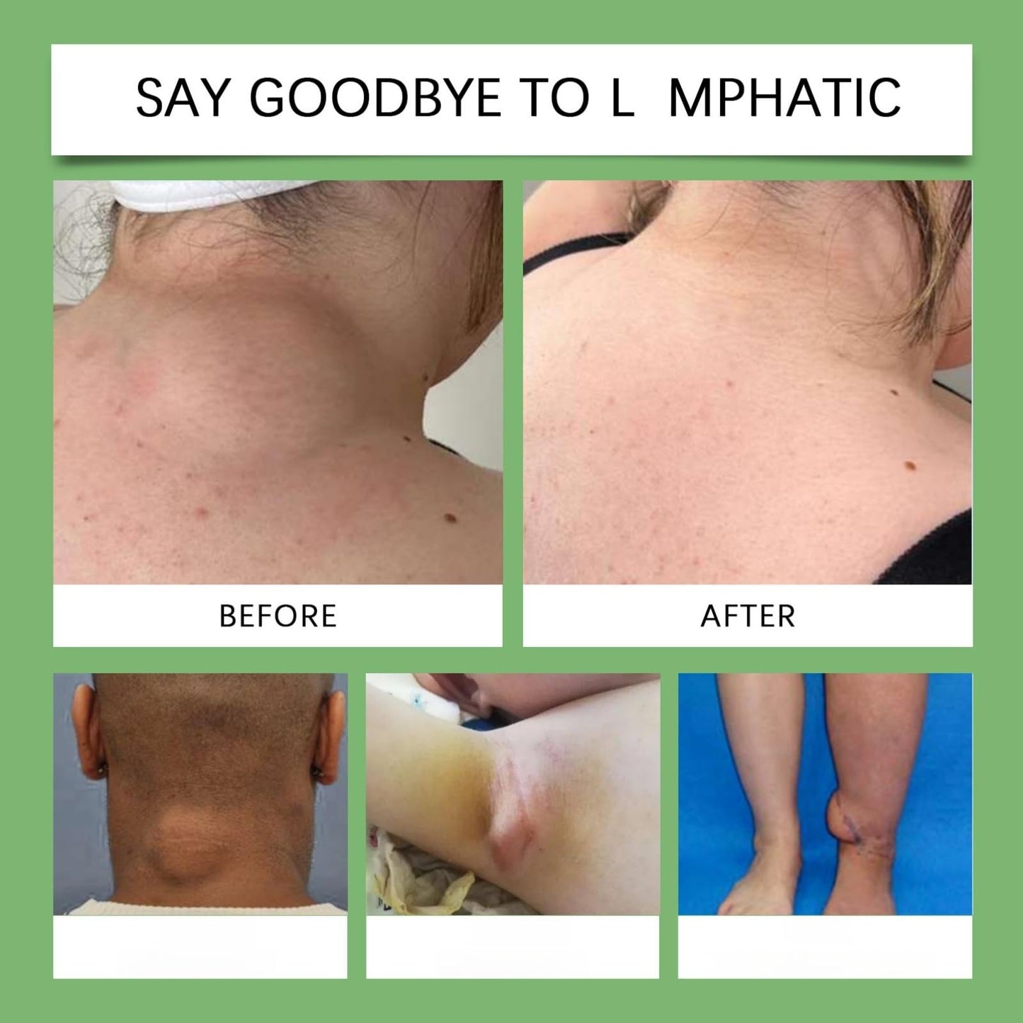 Lym/phatic De/tox Herbal Cream,Anti-Swelling Lotion for Neck Armpit,Lym/phatic Cream,Lymp/hatic Drainage Anti Ce/llulite Cream,An/ti Swelling Cr/eam,Skin Care Cre/am,Massage Cre/am for Neck Underarm
