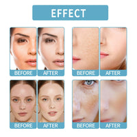 Oumun Liquid Skin Booster Serum,Liquid Solution Serum,Korean Skin Care,Hyaluronic Acid Serum,Face Serum for Women,Hydrating Serum,Anti Wrinkle Serum,Skincare Serum,Anti Aging Serum for Face,Facial Serum