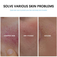 TONISABERY Repair Face Cream,B5 Repairing Balm,Skin Barrier Repair Cream,Anti Redness Moisturiser Cream,Smoothing Skin Repair Cream for Acne and Repair Damage Skin,Multi-Purpose B5 Face Cream for Sensitive Skin