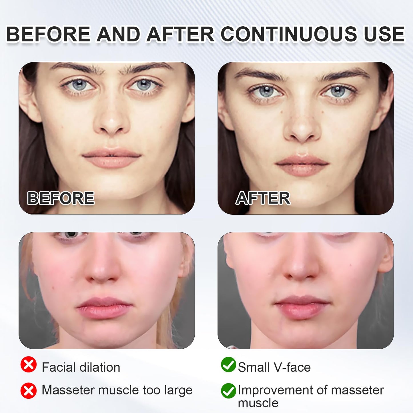 MADGININE Chin Strap for Double Chin V Line Face Lifting Chin Mask Chin Strap with 2 Gel Mask Reusable Double Chin Lift Mask Breathable and Comfortable Used to Enhance the Jawline for Women Men