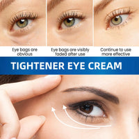 AINxtolm 5% Caffeine Eye Serum Roller,Eye Cream for Dark Circles and Puffy Eyes,Caffeine Eye Cream with 360° Massage Ball,Dark Circles Under Eye Treatment,Eye Cream for Eye Bags Remover,Eye Cream Anti Aging