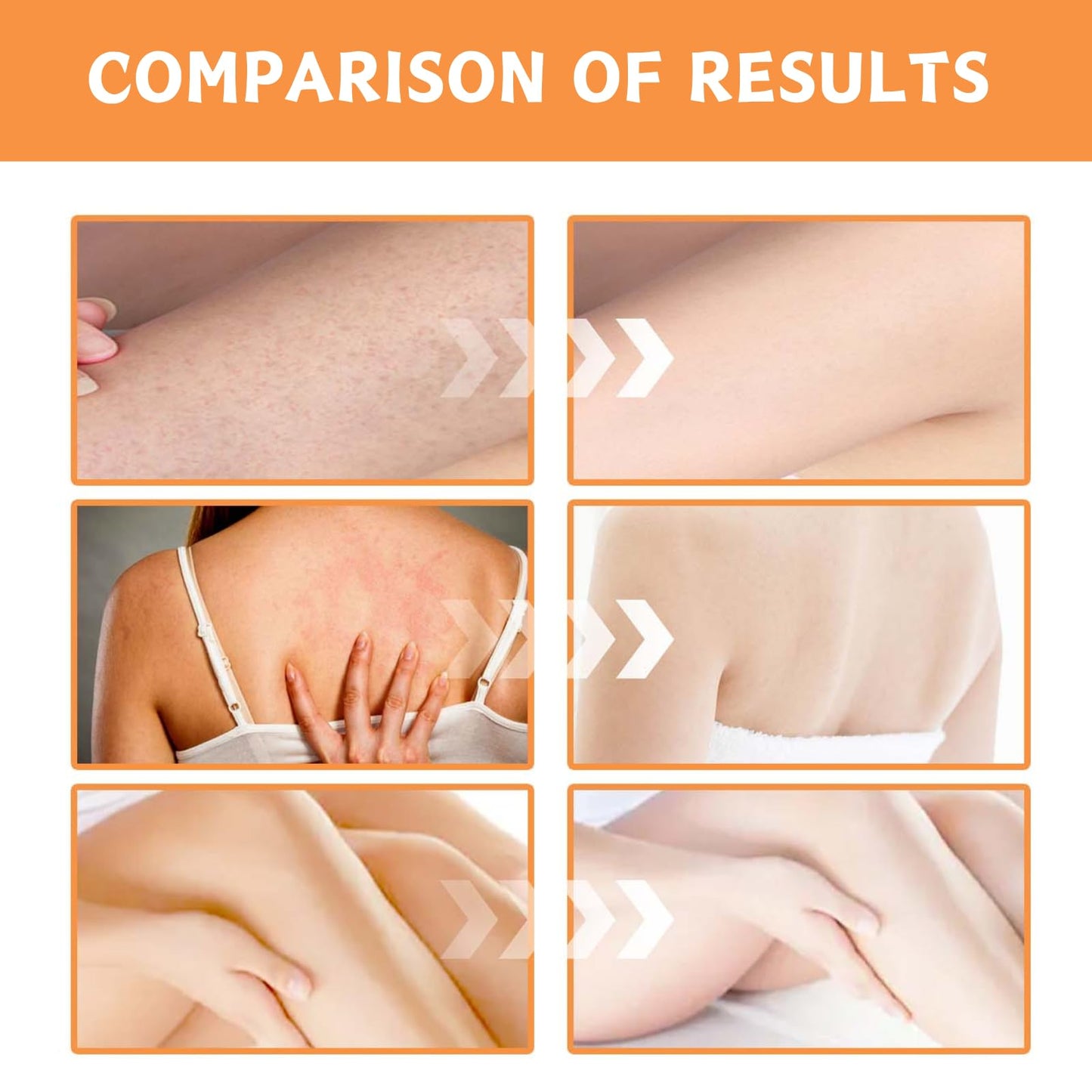 Trendyfave 520ml Niacinamide Pure Serum, Large-capacity 2 In 1 Face & Body Niacinamide Serum, Pore Reducer Face Serum,Shrinking Enlarged Pores Serums Skincare, Face Serum For Women, Balancing Sebum Production