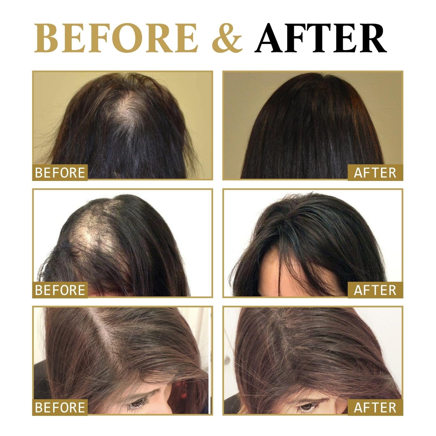 OuXing Batana Oil,Raw Batana Oil for Hair,Raw Ba/tana O/il Hair Treatment Cream,Bat/ana O/i/l for H/air Growth,Organic Bata/na Hair Growth Butter,Hai/r O/ils,Batan/a Ha/ir Oi/l,Hai/r Repair Mask