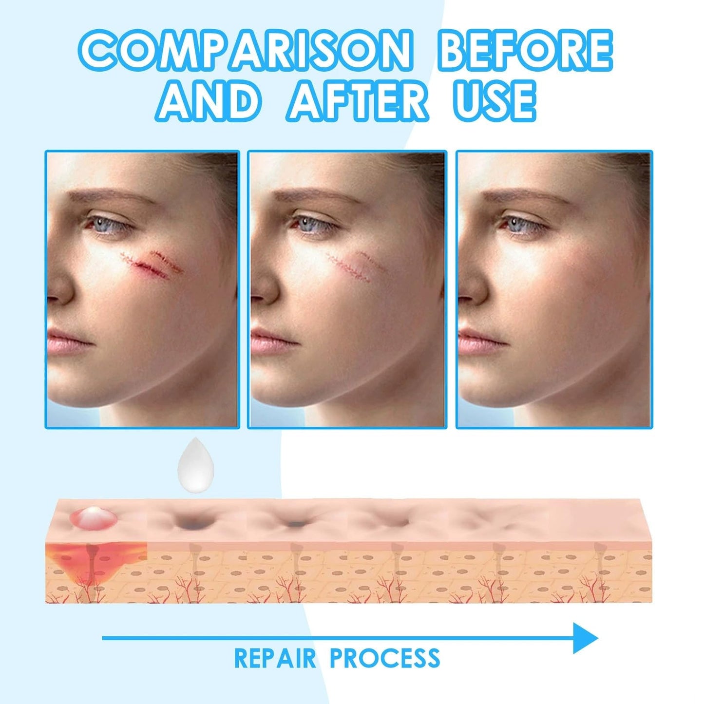 Jinjiar Scar Cream,Scar Removal Cream,Advanced Scar Gel for Old and New Scars,Skin Repair Cream for Old and New Scars,Scar Erase,Acne Scar Treatment,Scar Cream After Surgery,Scar Removalscar Cream for Face