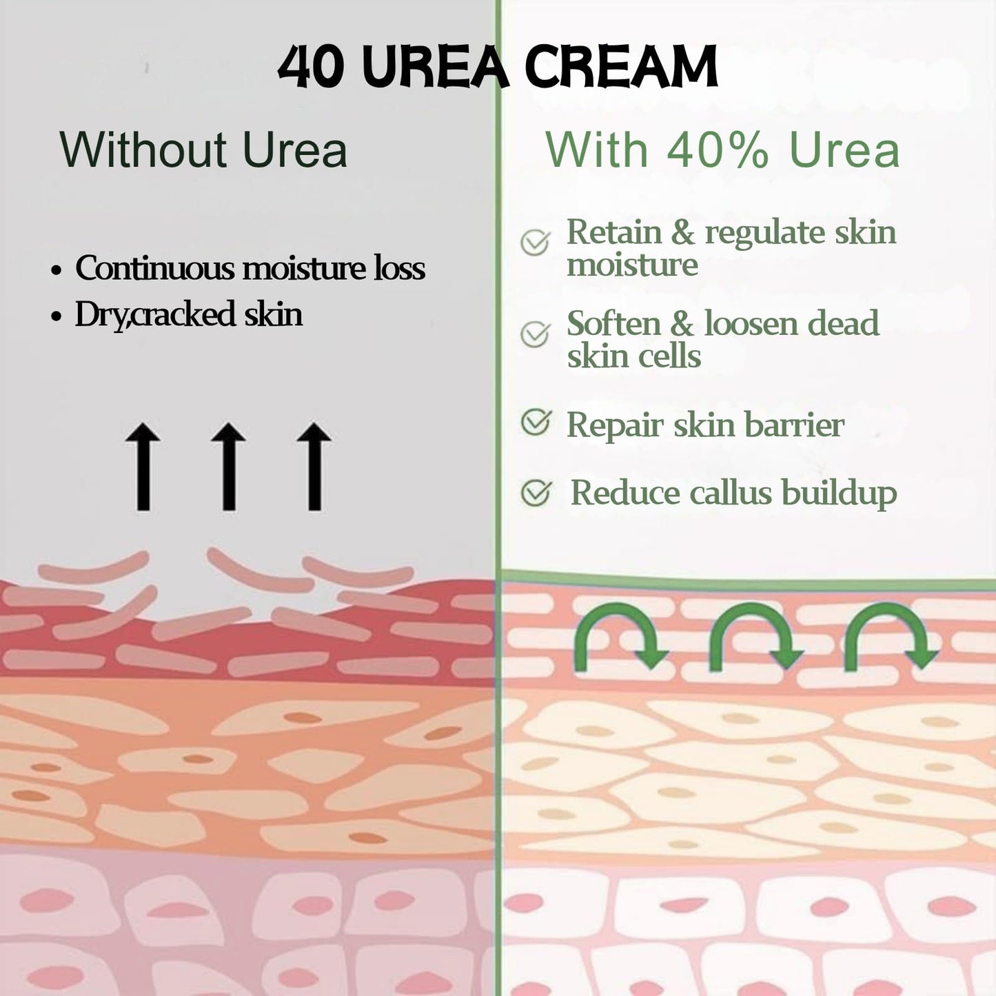 IZBEAUVO 40% Urea Foot Cream for cracked heels and Dry Skin – Cracked Heel Repair Cream & Intensive Foot Moisturiser – Targets Rough Skin Areas & Dry Feet Treatment - Suitable for all kinds of seasonal dryness