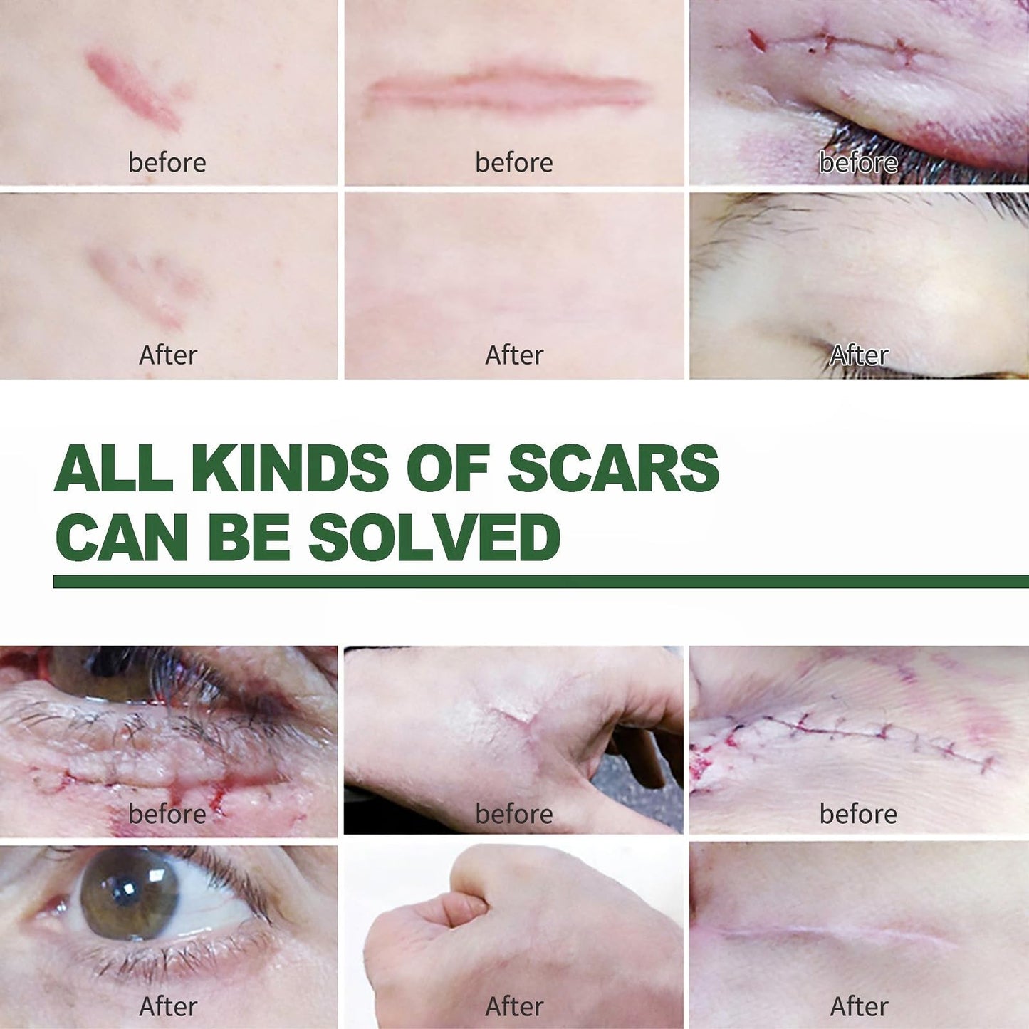 OuXing Wound Healing Oint-Ment,Relieve Skin Abrasions,Natral Healing Cream,Promote Skin HEA/ling Cream,Scab He/aling Cr/eam,Wo/und Cre/am Fade Scars,Wo/und He/aling Crea/m,Body Cre/am,WOU/nd Protection