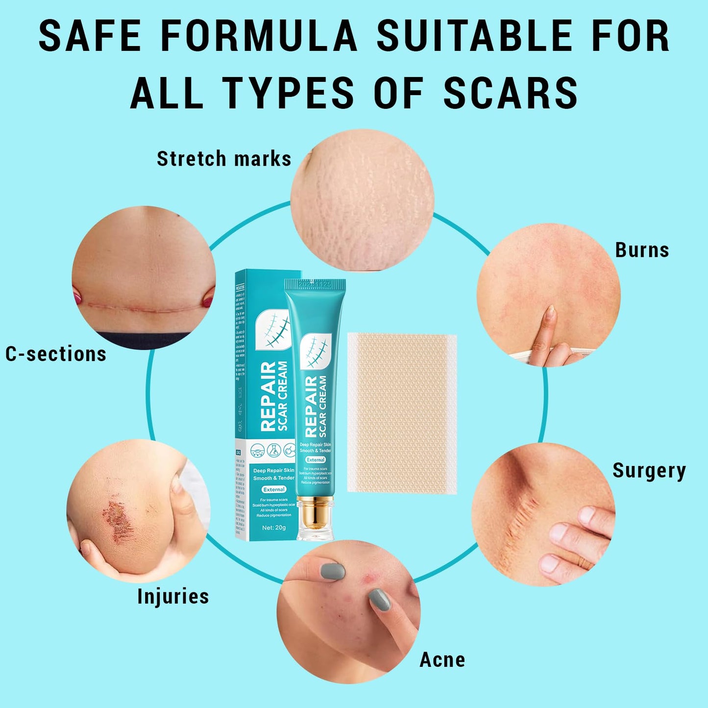 Benaewa 2 Pcs Scar Cream, Scar Removal Cream for Stretch Mark, Keloid Bump