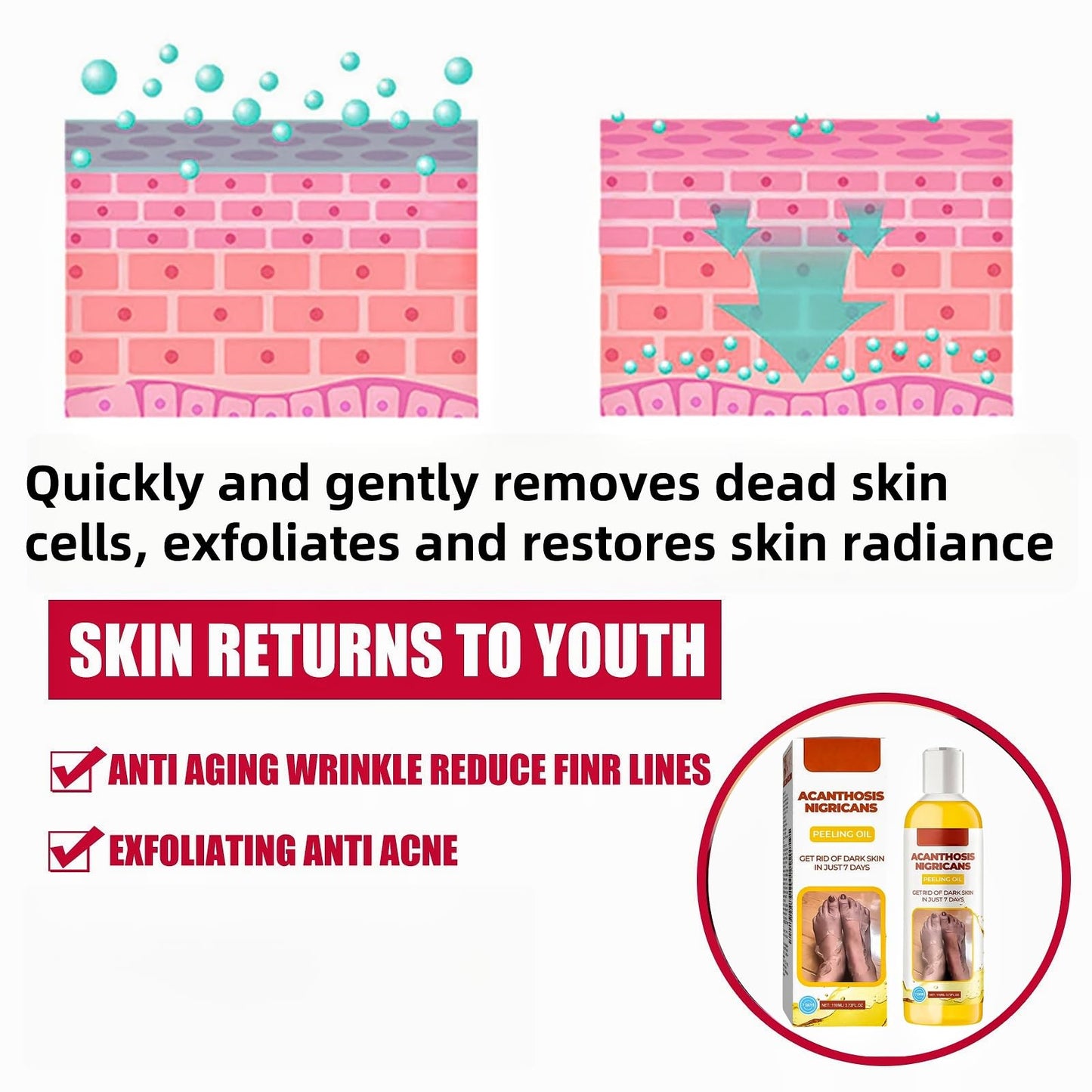 Exfoliating Yellow Peeling Oil for Da-Rk Skin,Body Glow Oil,Exfoliator Body,Brightening Bo-dy O-il,Bo-dy Exfoliate Peeling Oi-l,Whole Bod-y Sk-in Exfoliator,Bod-y O-il for Women,Sk-in Lightening