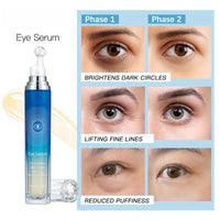AINxtolm 5% Caffeine Eye Serum Roller,Eye Cream for Dark Circles and Puffy Eyes,Caffeine Eye Cream with 360° Massage Ball,Dark Circles Under Eye Treatment,Eye Cream for Eye Bags Remover,Eye Cream Anti Aging
