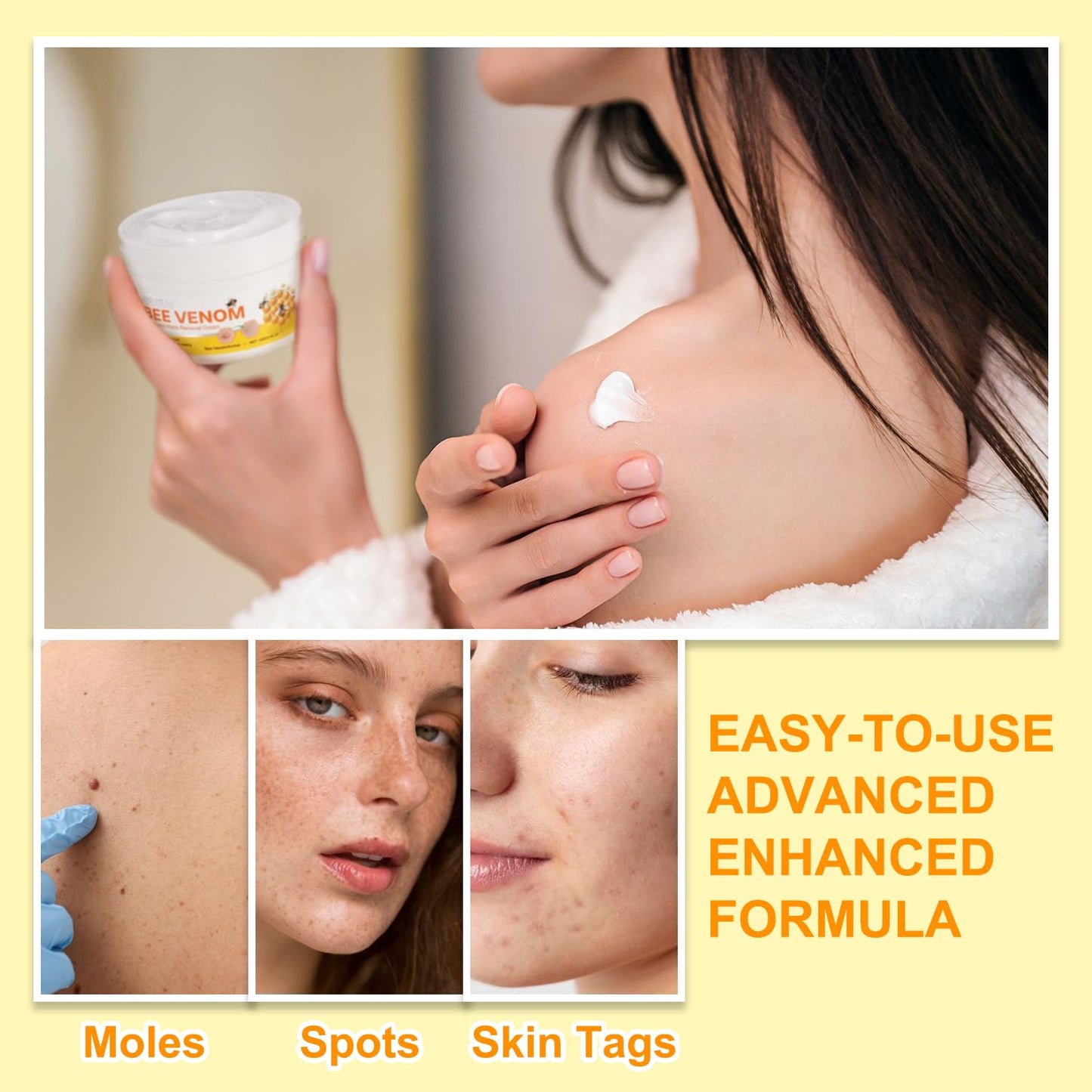 Generic Bee Venom Cream, 2024 New Upgrade Bee Venom Treatment Cream, for Wrinkles and Dry Skin & Dry Skin Bee Venom Wart & Moles Removal Cream Skin Moisturiser -Bee Venom All in One Cream for Body & Face Bee