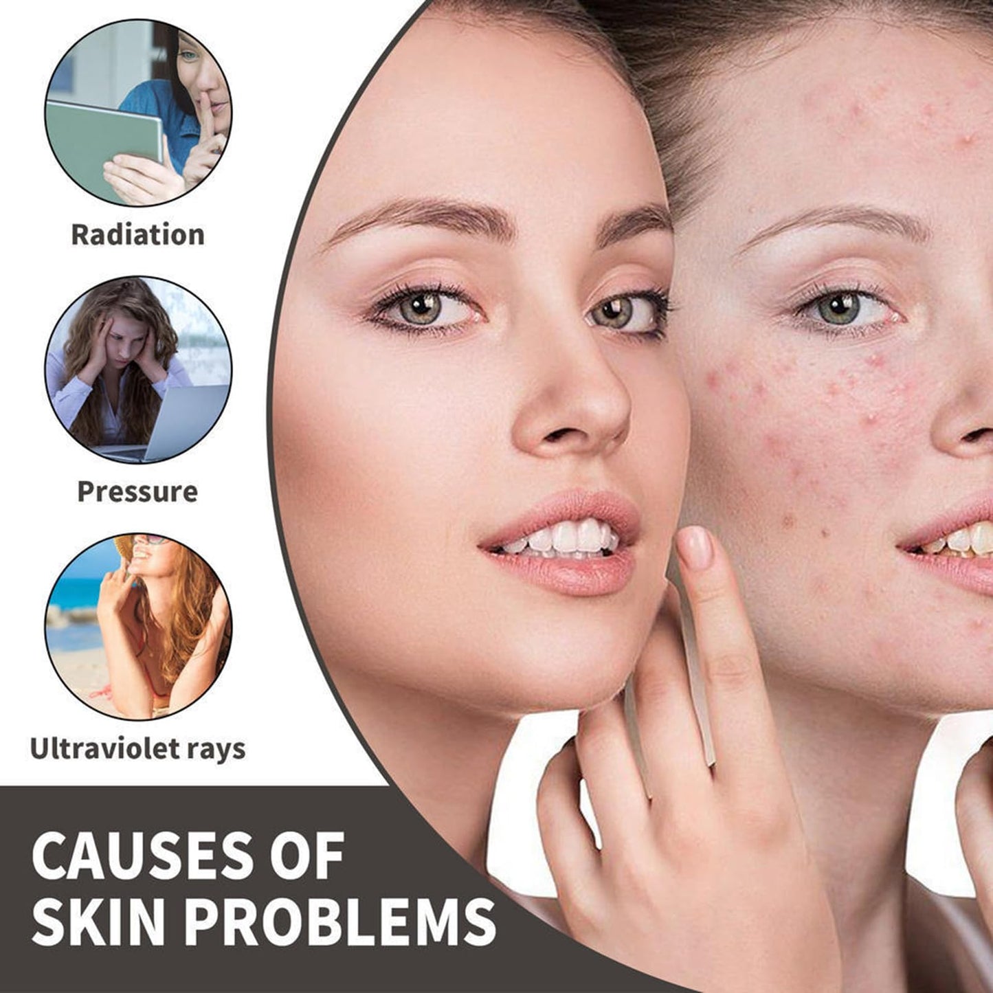 (2PCS)Azelaic Acid Face Cream, Azelaic Acid 12% Facial Serum Cream, Niacinamide & Vitamin C for Redness Face, Dark Spot, Rosacea,Acne,Face Skin Care Beauty Products,Skincare for All Skin Types 20G (2)