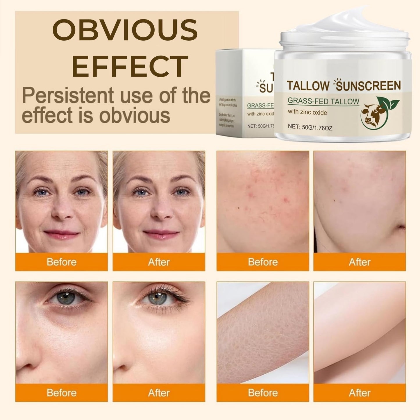 SingHao Beef Tallow Sunscreen SPF 50,Beef Tallow Balm for Skin,Sun Crea/m Face Moisturiser,Be/ef Tall/ow Skin Care,Tall/ow Balm Instant Sun Protection,SP/F 50 Face Moisturiser,Be/ef Tall/ow Cre/am Face Cream