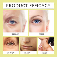 QinZiEn Lutein Eye Oil,Vitamin C Lutein E-ye Oil,Under Ey-e Cream for Dark Circles,Lu-tein Essential Oil,Tightening Eye Cr-eam,E-ye Cre-am Anti Aging,Dry Skin Moisturiser,E-ye Wrinkle Cr-eam,Moisturizer Face