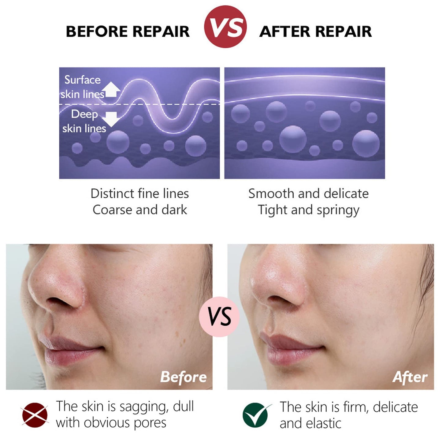 Retinol Cream - Face Cream Anti-Aging Wrinkle Night/Day Cream With 2.5% Retinol - Eye Face Moisturiser to Help Skin Regenerating Reduce Wrinkles, Fine Lines, Dry Skin Age Spots 30ml
