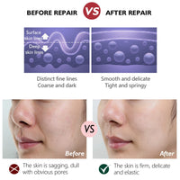 Retinol Cream - Face Cream Anti-Aging Wrinkle Night/Day Cream With 2.5% Retinol - Eye Face Moisturiser to Help Skin Regenerating Reduce Wrinkles, Fine Lines, Dry Skin Age Spots 30ml