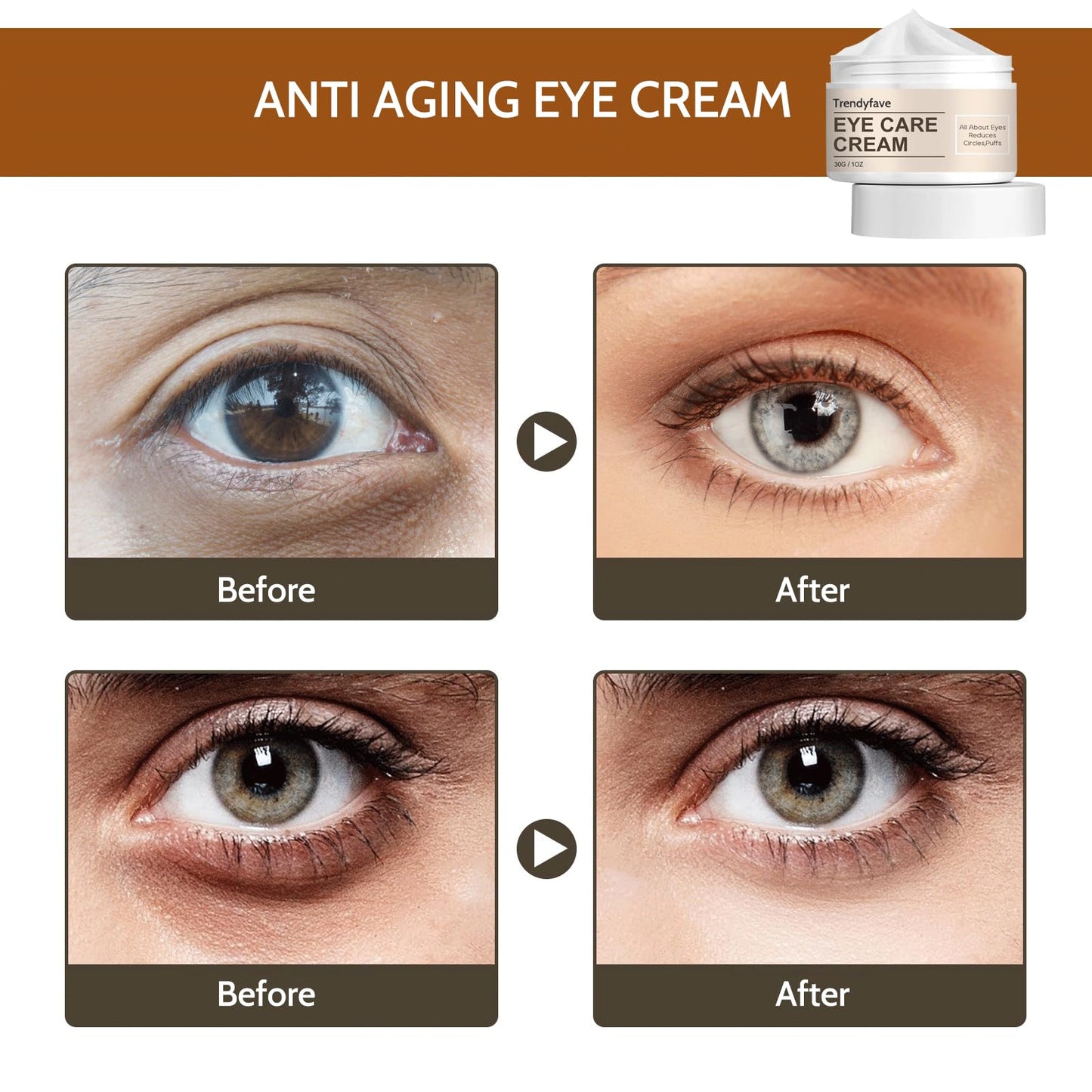 Trendyfave Eye Cream Anti Aging, Eye Cream For Dark Circles And Puffy Eyes, Moisturising Eye Tightening Cream, Under Eye Cream, Fade Fine Lines, Tight, Reduce Eye Bags