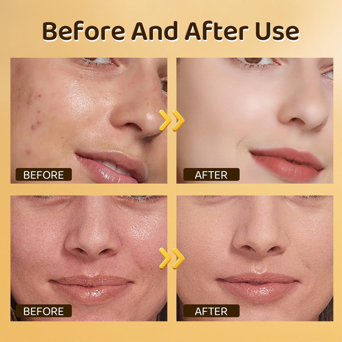 BoloShine Turmeric Face Cream, Anti-Wrinkle Skin Lightening Cream, Facial Moisturiser, Dark Spot Corrector Remover, Soothing Hydrating Brightening for Face & Body, 50g