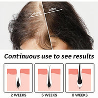 OuXing De/oxyr Gel Hair Growth,Hair Growth Oil,De/oxyr Growt/h Serums,Hai/r Gro/wth Serum,Multifunctional Serums Oil for Strengthening Ha/irs,Thickening Gel Strengthens,Hair Serum for Dry Damaged Hair,60ml