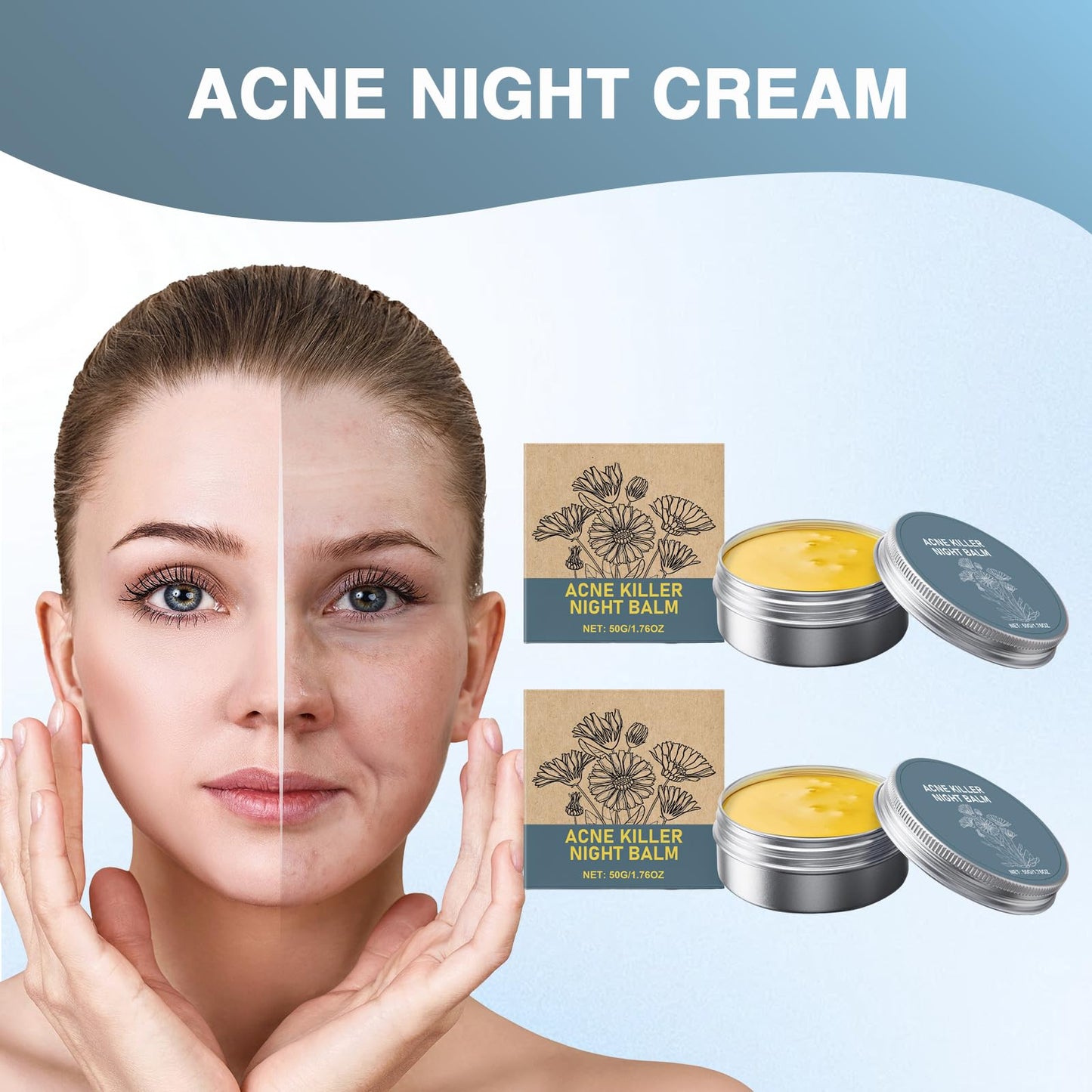 DOOCECIY 2 PCS Pimple Cream, Nourishing Acne Balm for All Skin Types