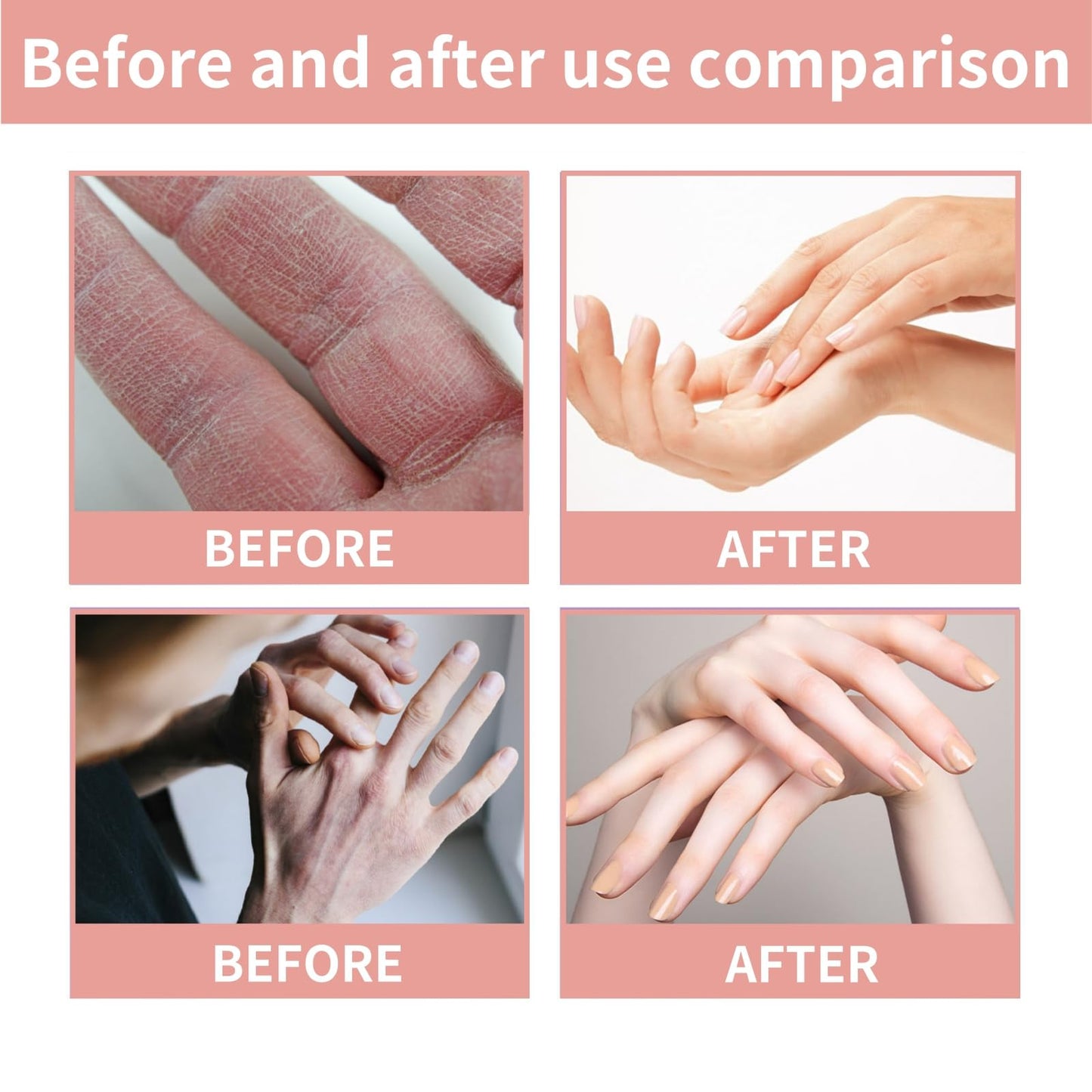 Jinjiar Retinol Hand Cream,Firming Anti-Aging Hand Lotion,Relief Intense Moisture Hand Balm,Moisturizer for Dry Cracked Hands,Anti Aging Hand Cream,Retinol Hand Balm Anti Aging,Protects Skin&Nails