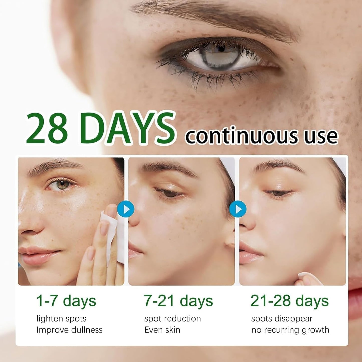 QinZiEn Anti-Hyperpigmentation Cream,Cream for Hyperpigmentation Treatment,Anti Aging Face Cre/am,Moisturiser Face Women,Dark Spot Remover,Wrinkle Filler Face Moisturiser,Intense Face Moisturiser 30g