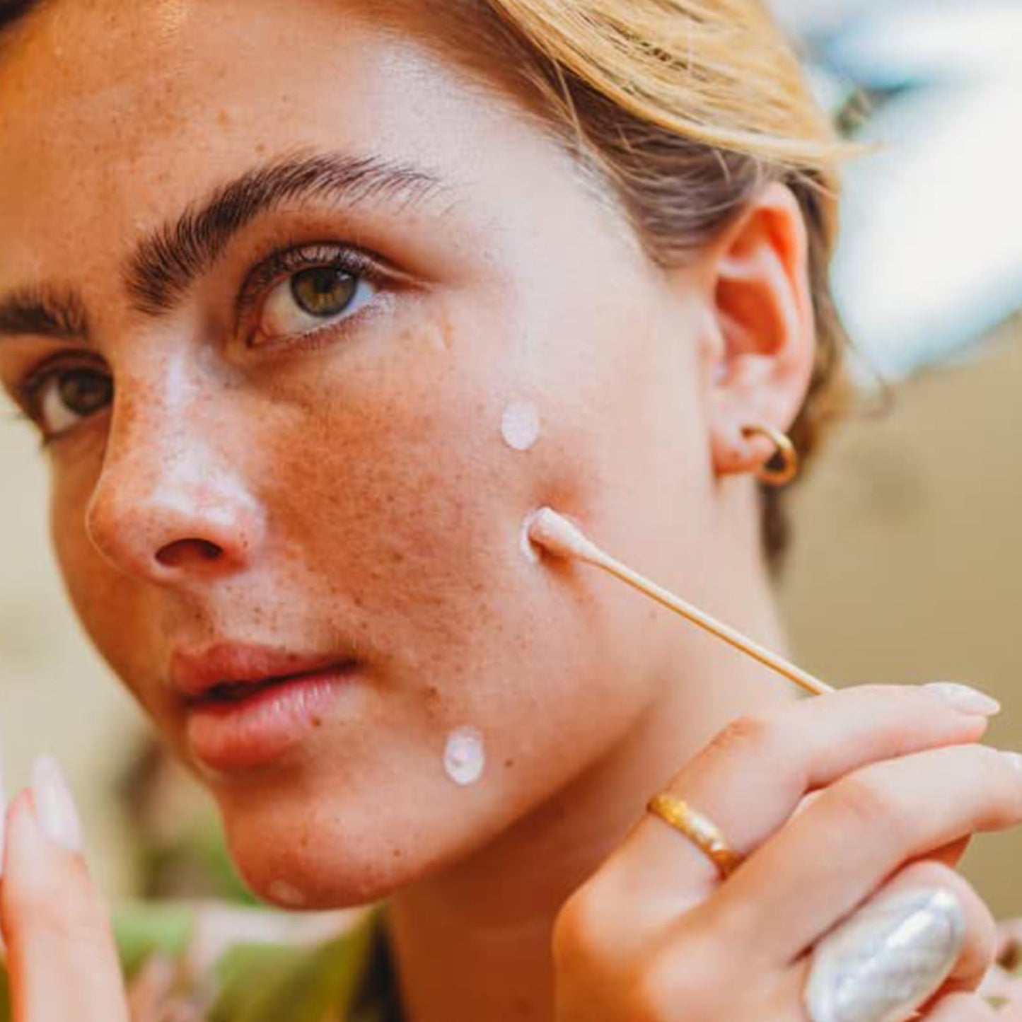 KAYZON Anti Acne Serum - Drying Lotion for Acne, Anti Acne Face Serum Dry Out Blemishes & Pimple Reduce Redness Acnecide Face Lotion for Teenage Girl Women Men Skin Care