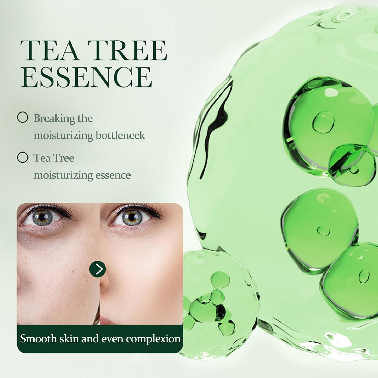 NatrLuxe Tea Tree Zits Cream 50g - Cream With Oil Control, Soothing & Moisturizing - Improve Zits & Blemishes - Clearer Skin Solution