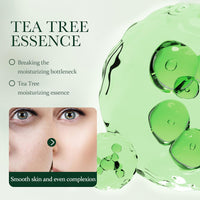 NatrLuxe Tea Tree Zits Cream 50g - Cream With Oil Control, Soothing & Moisturizing - Improve Zits & Blemishes - Clearer Skin Solution