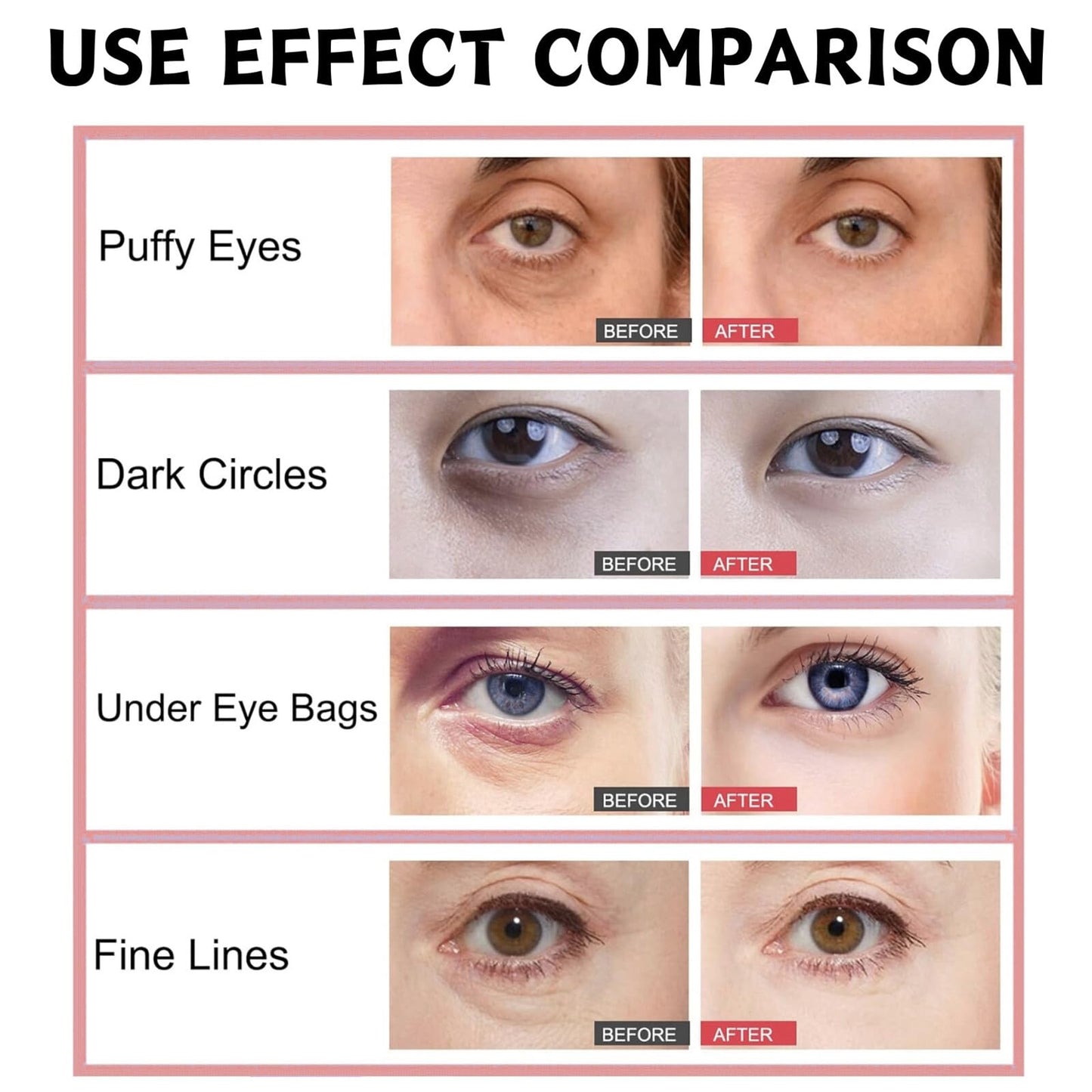 Eye Radiance Restoring Retinol Eye Cream Balm,Anti Wrinkle E-ye Cream Balm,Caffeine E-ye Creams for Dark Circles and Puffy Eyes,Korean Skincare Hydrating E-ye Creams for Dry Skin Around Eyes