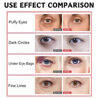 Eye Radiance Restoring Retinol Eye Cream Balm,Anti Wrinkle E-ye Cream Balm,Caffeine E-ye Creams for Dark Circles and Puffy Eyes,Korean Skincare Hydrating E-ye Creams for Dry Skin Around Eyes