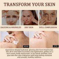 NIFEISHI Whipped Beef Tallow Skin Care, Tallow Face Cream, Grass Fed Beef Tallow and Honey Balm, Organic & Natural Moisturiser Deeply Nourish Face & Body for Women and Men, 120g/4.2 oz