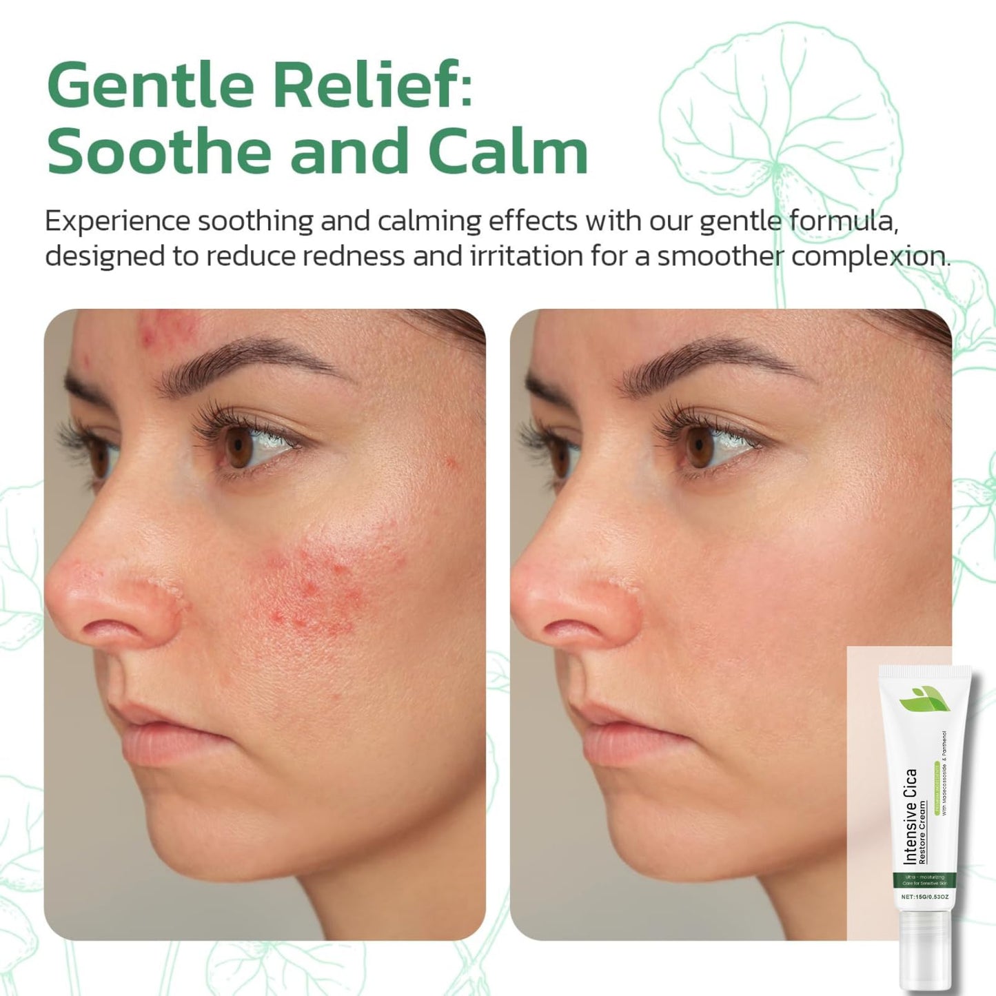 IZBEAUVO Intensive Cica Repair Cream, Centella Moisturizer Phytocin Cream Soothing Centella Asiatica Moisturizer Face, Ultra-Soothing & Hydrating Korean Care Cream for Sensitive Skin(15g/0.53oz)