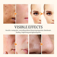 IZBEAUVO Turmeric Clay Mask,Turmeric Vitamin c Face Mask,Clay Face Mask,Turmeric Mask Stick,Clay Mask for Pores Deep Cleanse,Reduce Acne Dark Spots & Pores Anti-Aging,Brightening for Men and Women