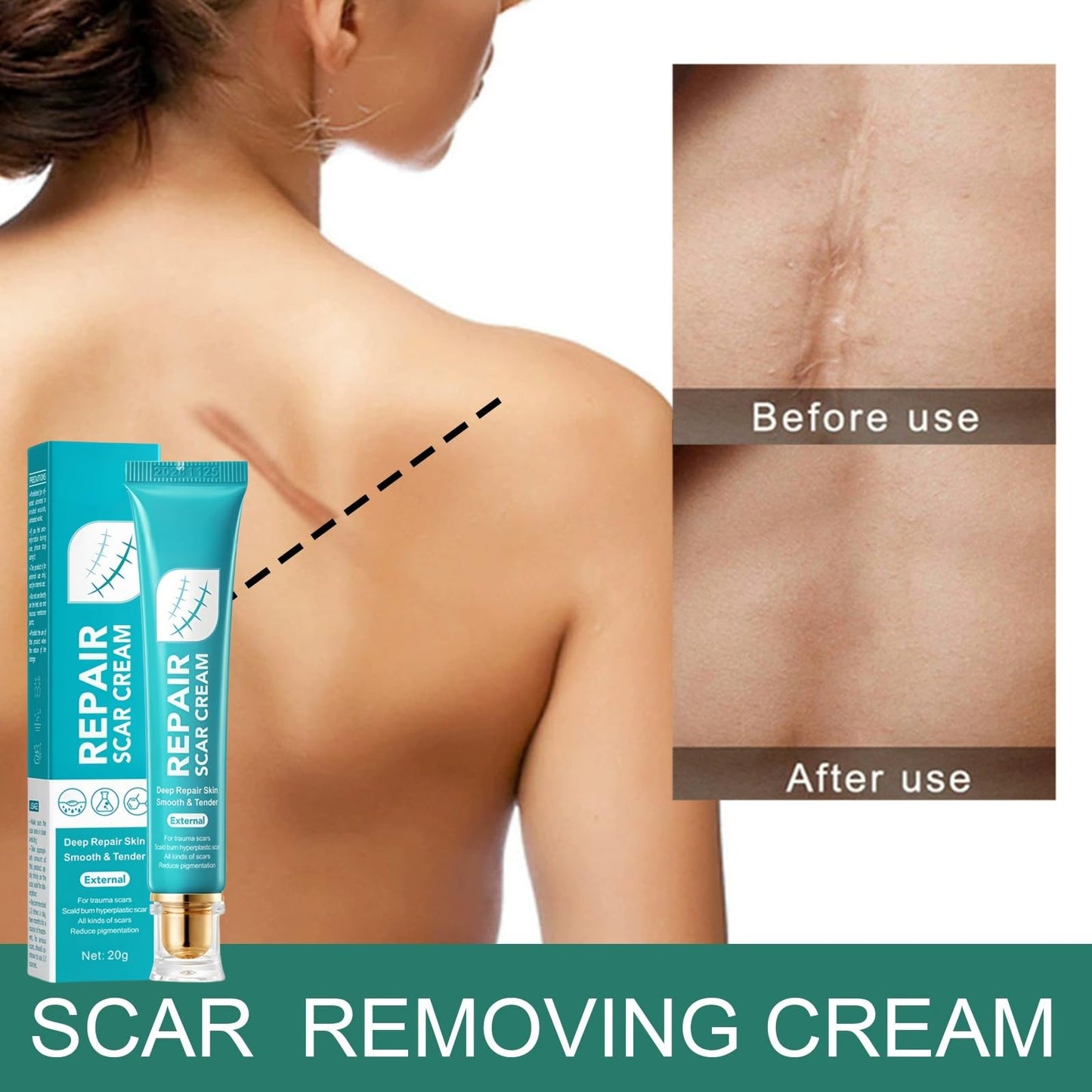 Jinjiar Scar Cream,Scar Removal Cream,Advanced Scar Gel for Old and New Scars,Skin Repair Cream for Old and New Scars,Scar Erase,Acne Scar Treatment,Scar Cream After Surgery,Scar Removalscar Cream for Face