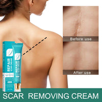 Jinjiar Scar Cream,Scar Removal Cream,Advanced Scar Gel for Old and New Scars,Skin Repair Cream for Old and New Scars,Scar Erase,Acne Scar Treatment,Scar Cream After Surgery,Scar Removalscar Cream for Face