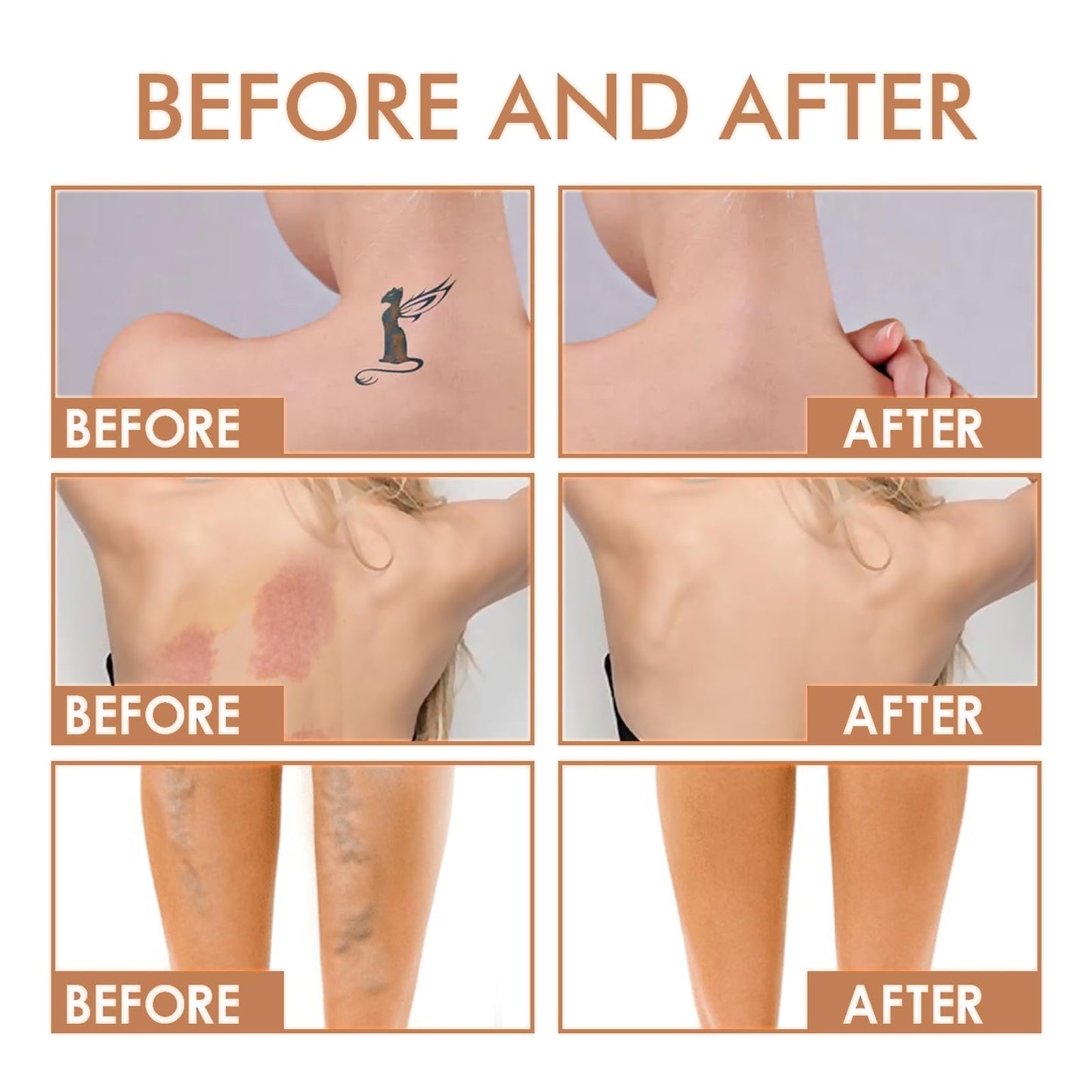 OuXing Leg Makeup Full Coverage Waterproof,Leg Makeup Waterproof No Transfer,Leg Mak-eup to Cover Veins,Concealer for Mature Skin,Le-g and Body Scar Tatto Cove-r Up,Le-g Makeu-p Lotion,Tatto Cove-r Up,1