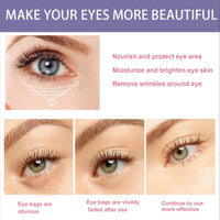 CrownLite Retinol Eye Cream Anti Aging, Dark Circle Eye Cream, Anti-Wrinkle Moisturizing with Niacinamide Hyaluronic Acid and Caffeine for Men and Women, Reduce Eye Bags, Anti Wrinkle and Fine Lines