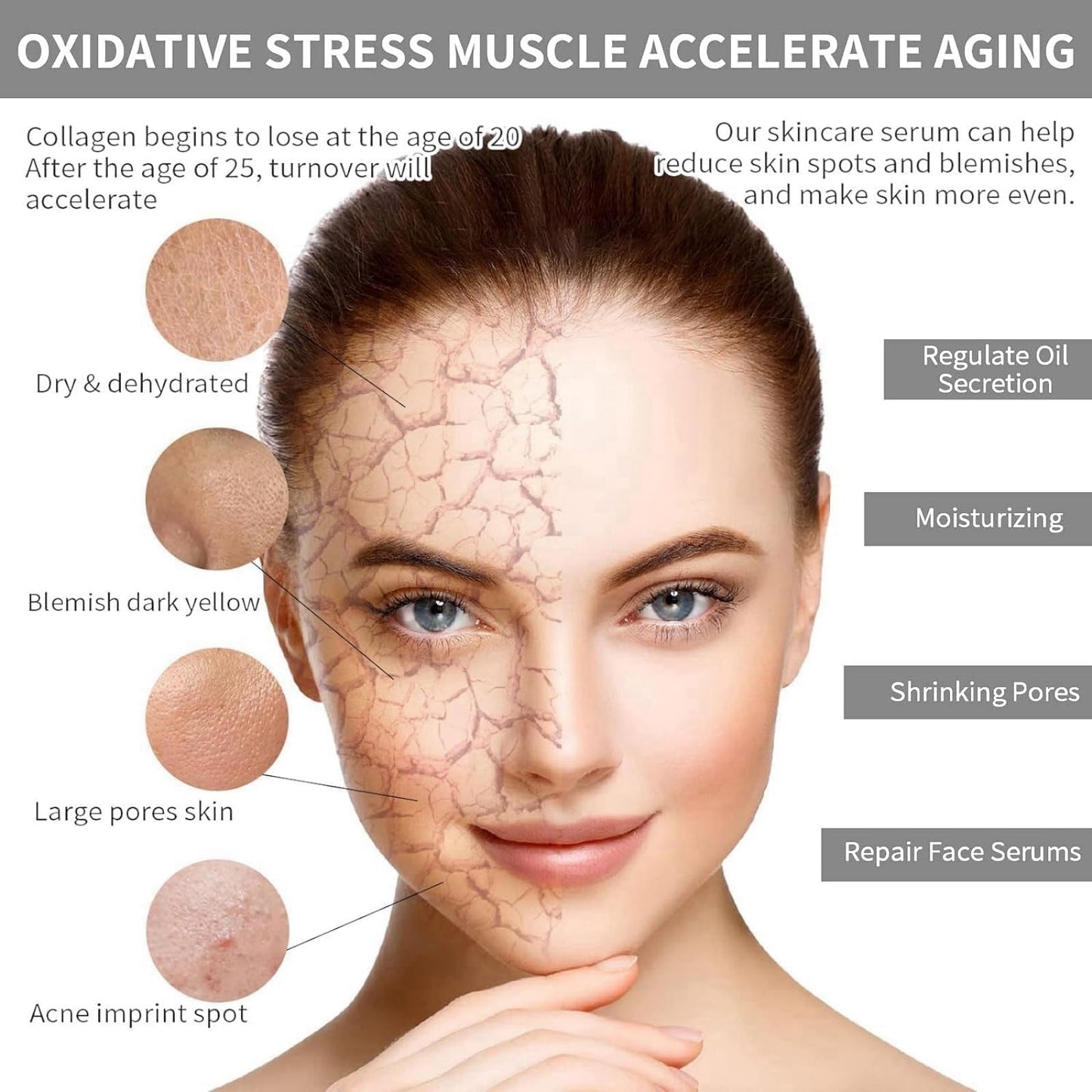 Xinyig Infusion Micro Facial System,Glow Infusion Micro System,Hyaluronic Acid Microneedling Essence for Glowing Skin,Smooth Skin Facial Serum,Micro Anti-Aging Facial System,Micro Needling Kit,Skin-Firming