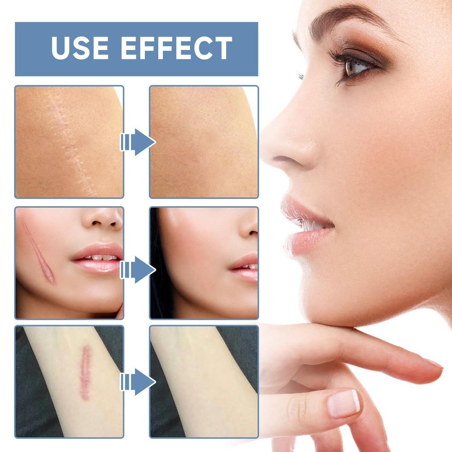 Jinjiar Scar Cream,Scar Removal Cream,Advanced Scar Gel for Old and New Scars,Skin Repair Cream for Old and New Scars,Scar Erase,Acne Scar Treatment,Scar Cream After Surgery,Scar Removalscar Cream for Face