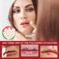 OuXing Cold Sore Treatment Cream,Cold Sore Cream,C/Old S/ore Treatment,C/Old S/ore C/Ream for Lips,Co/ld So/re Relief C/Ream,So/re Lips T/reatment,Mouth SOR/e T/reatment,Oral Gel Extra Strength,Lip Care