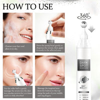 IZBEAUVO Dark Spot Remover For Face With Roller, Dark Spot Correcting Serum, Dark Spot Corrector For Age Spot Sun Spot Freckles Brown Spot, Melasma Treatment For Face, Hydrating Serum, Glow Serum