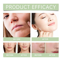 QinZiEn Zero Pore Pads,Dual-Textured Facial Toner Pads for Exfoliation and Minimizing Pores,Exfoliating Face Pads,Cotton Face Pads,Pore Pads,Exfoliating Pads,Exfoliating Pads Face,Makeup Pads,Cosmetic Pads