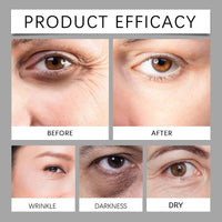 Instant Firm Temporary Eye Tightener,Eye Cream,Instant Firm Ey-e Cream,Tightening Ey-e Cre-am Anti Aging,Instant Fir-m E-ye Tightener,Fir-ming E-ye Cre-am,Instant Wrinkle Remover
