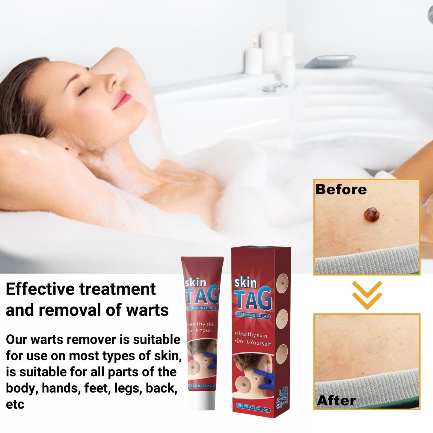 Jinjiar Wart Remover Cream,Effective Wart Removal,Mole Remover,Fast Effective Safe Skin Mole Removal,Wart Treatment for Face & Hands & Body,Wart Remover for Hands,Wart Re-Mover for Face,Flat Wa-rt Remover