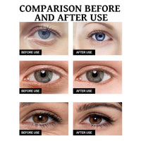Jinjiar Lumi Eye Balm for Under Eye Bags,Erases Eye Bags within Minutes,Anti Aging under Eye Cream,Lumi Eye Balm Serum,Eye Cream for Dark Circles and Puffy Eyes,Eye Bags Remover,Eye Cream for Wrinkles,Eye Bag