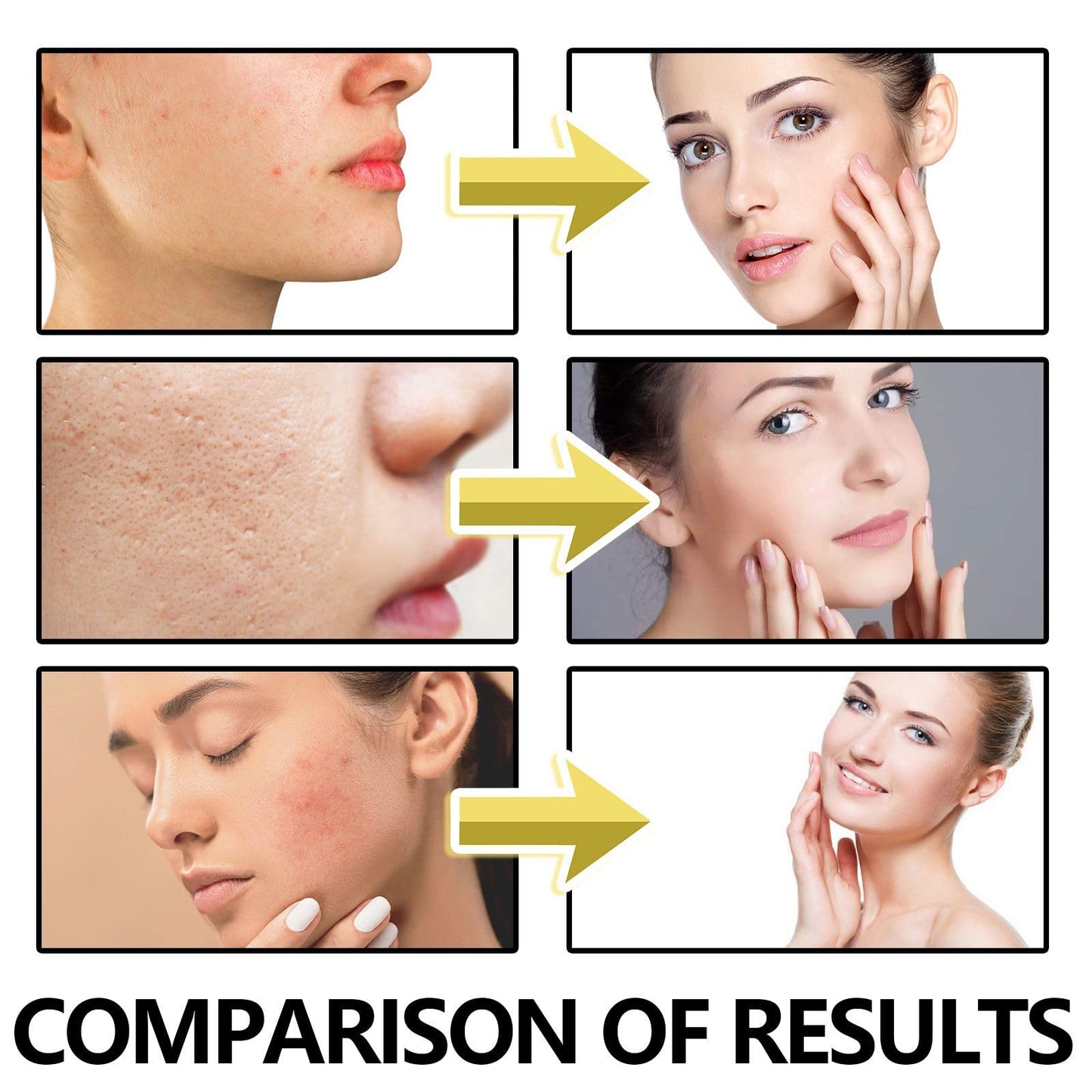 Anti-Wrinkle Filler Cream,Power Wrinkle Fix Cream,Wrinkle Fil-ler Serum,Wrin-kle Filler Face Crea-m,Skin Tightening Cre-am for Face,Fac-e Moisturizer for Women,Fa-ce Serum for Women,Anti Ageing Cre-am